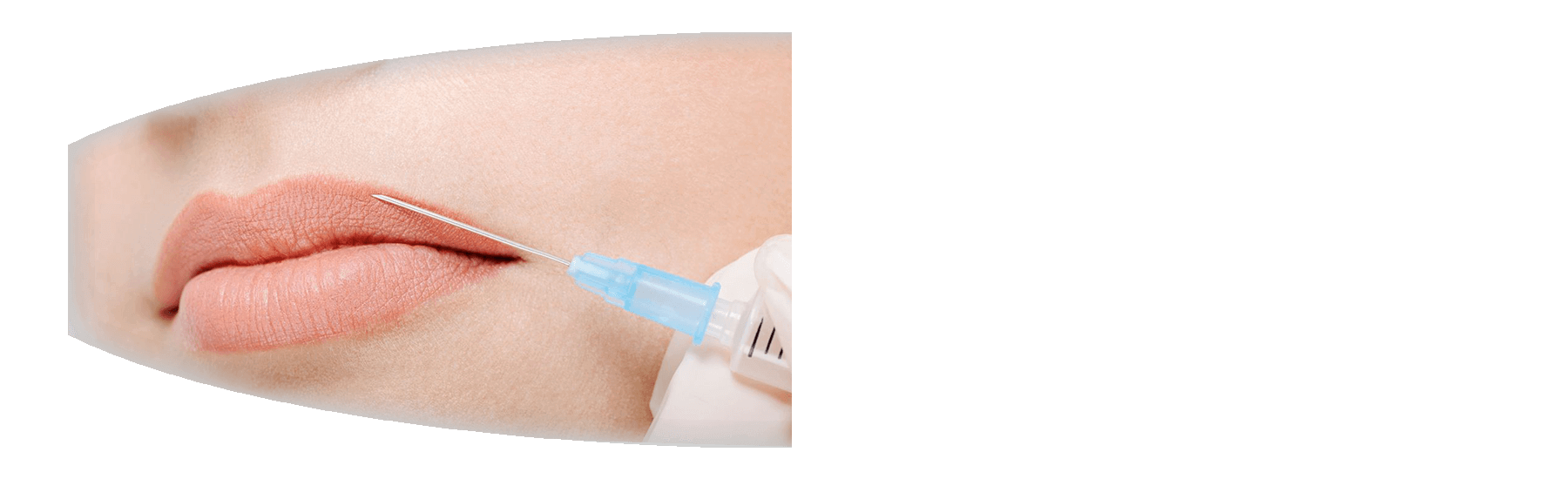 Wellsprings-medical-quality-luxury-Botox-Injectable-Fillers-beauty-service.png